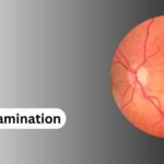 fundus examination