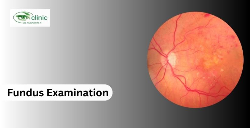 fundus examination