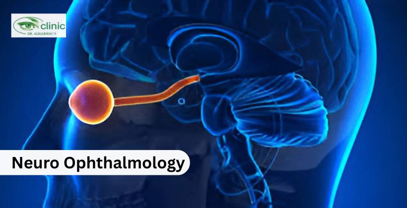neuro ophthalmology
