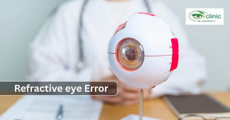 Refractive eye Error