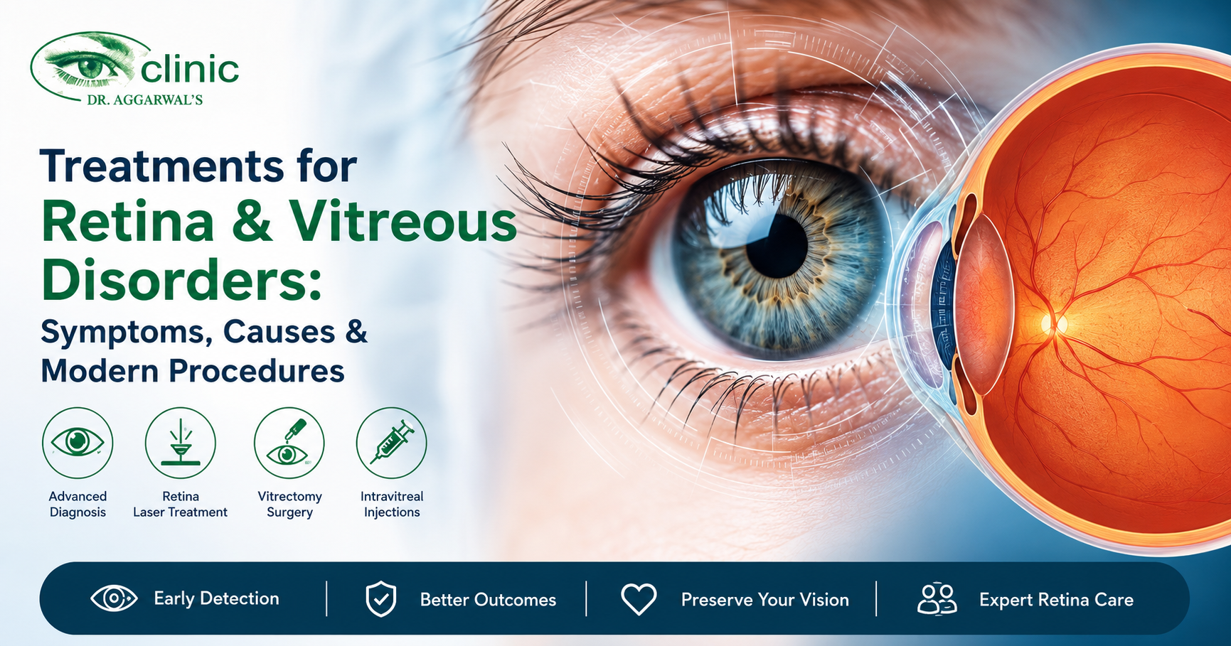 Treatments for Retina & Vitreous Disorders showing retinal anatomy, advanced eye diagnostics, laser treatment, vitrectomy surgery, and retina care by Dr. Aggarwal's Eye Clinic.